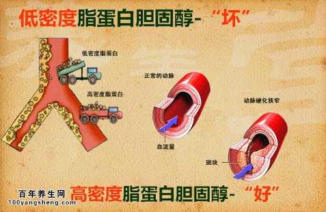 20140622养生堂视频和笔记高血脂斑块胆固醇植物固醇睑黄疣