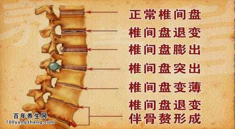 20140814养生堂视频和笔记:刘忠军讲腰疼的原因有哪些