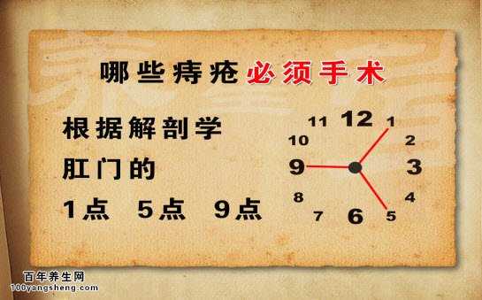 痔疮图片