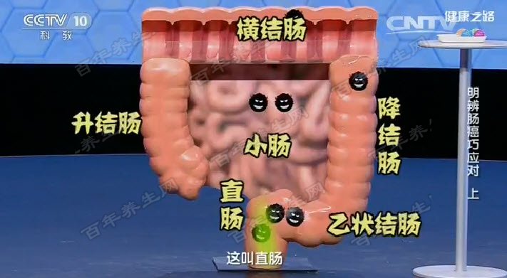 99%以上癌症发生在大肠中,最常见的部位在靠近肛门的直肠,占大肠发生