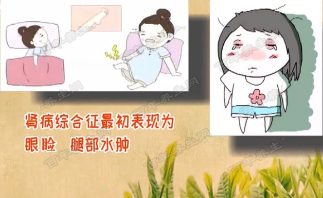 20190225饮食养生汇视频和笔记付冬梅肾病综合征水肿凉拌瓜皮