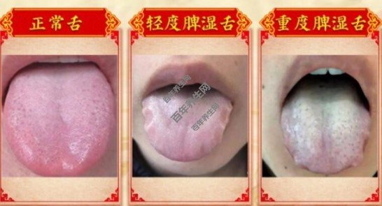 ������vsƢʪ��